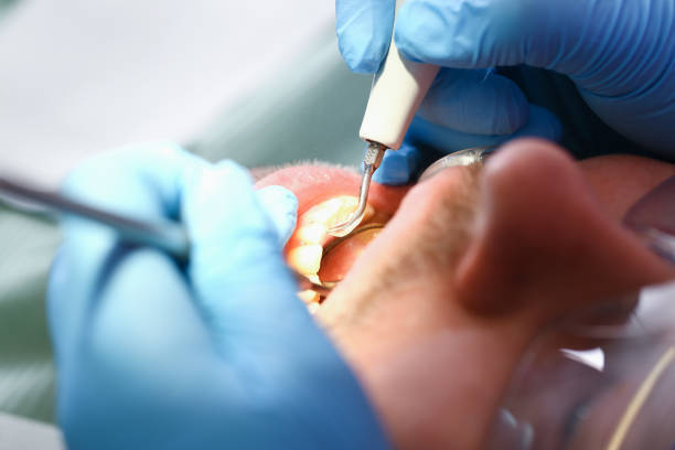 Best Broken or Cracked Tooth Emergency Dentist in Rose Valley, PA