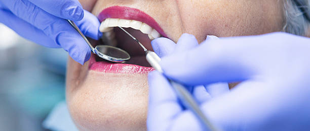 Best Broken or Cracked Tooth Emergency Dentist in Rose Valley, PA